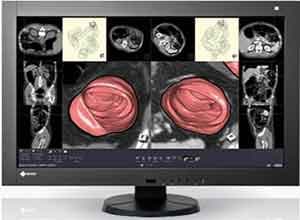 Eizo RadiForce RX430 Color Màn hình LCD Eizo RadiForce RX430 Color Màn hình LCD