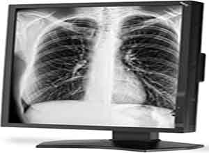 NEC 21 Inch Grayscale 3-Megapixel Medical Diagnostic Màn hình MD211G3 NEC 21 Inch Grayscale 3-Megapixel Medical Diagnostic Màn hình MD211G3