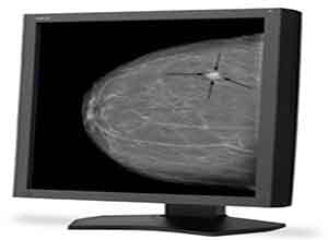 NEC 21 Inch Grayscale 5-Megapixel Medical Diagnostic Màn hình MD215MG-S5 NEC 21 Inch Grayscale 5-Megapixel Medical Diagnostic Màn hình MD215MG-S5