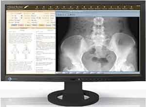 Eizo RadiForce 23 Inch Color LCD Màn hình MS230W Eizo RadiForce 23 Inch Color LCD Màn hình MS230W