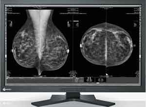 Eizo RadiForce GX1030 Monochrome Màn hình LCD Eizo RadiForce GX1030 Monochrome Màn hình LCD