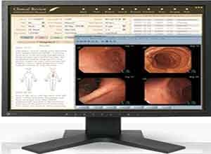 Eizo RadiForce 19 Inch Color LCD Màn hình MX191 Eizo RadiForce 19 Inch Color LCD Màn hình MX191