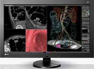 Eizo RadiForce RX840 8MP 92cm 36.4 Inch Color Màn hình LCD Eizo RadiForce RX840 8MP 92cm 36.4 Inch Color Màn hình LCD