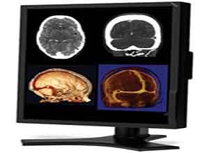 NEC 21 Inch Color 2-Megapixel Medical Diagnostic Màn hình MD212MC NEC 21 Inch Color 2-Megapixel Medical Diagnostic Màn hình MD212MC