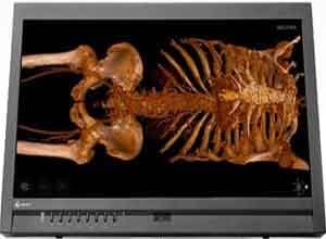 Eizo RadiForce 23 Inch Multitouch Color LCD Màn hình MS231WT Eizo RadiForce 23 Inch Multitouch Color LCD Màn hình MS231WT