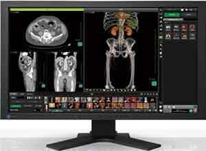 Eizo RadiForce MX241W 24.1 Inch Color Màn hình LCD Eizo RadiForce MX241W 24.1 Inch Color Màn hình LCD