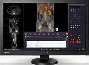 Eizo RadiForce MX270W 27 Inch Color Màn hình LCD Eizo RadiForce MX270W 27 Inch Color Màn hình LCD