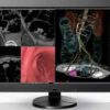 Eizo RadiForce RX840 8MP 92cm 36.4 Inch Color Màn hình LCD