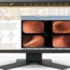 Eizo RadiForce 19 Inch Color LCD Màn hình MX191