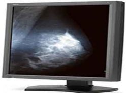 NEC 21 Inch 5MP medical diagnostic display MD211G5